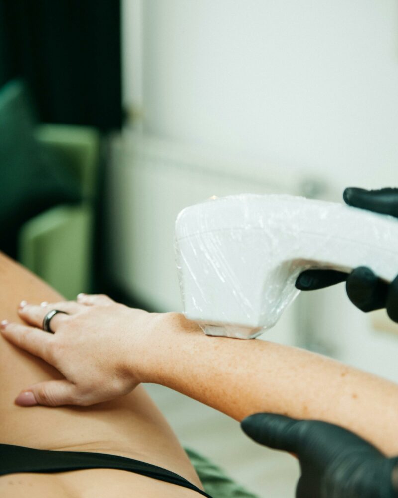 Photo épilation Annecy Bouge